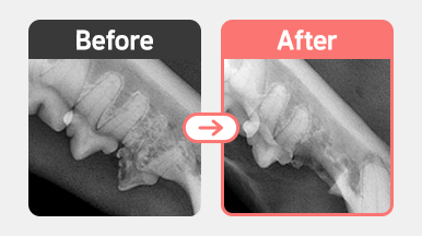 7살 페르시안 고양이 치아흡수성병변 FORL Type 3 병변 X-ray, 치근 흡수가 진행되어 Crown Amputation이 적합한 부위