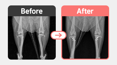 2살 비숑의 양측 슬개골 탈구 교정 수술 후 방사선 사진. 무릎 홈 성형술과 경골 조면 전위술을 통해 정렬이 개선됨.