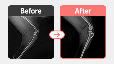 5살 요크셔테리어의 좌측 슬개골 탈구 교정 수술 방사선 사진. 대퇴고랑성형, 경골조면 이식 및 외측관절낭 부분절제를 통해 안정성 확보.