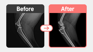수술 후 양측 슬개골 정복 상태가 안정적으로 유지되고 있는 요크셔테리어의 후속 방사선 사진. 보행 회복 중.