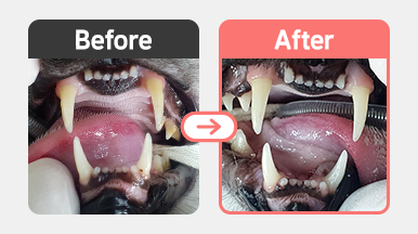 FORL Type 3 및 Type 2 양상이 혼합된 부위 2의 방사선 사진 – 치근 흡수 확인