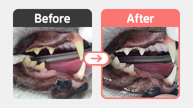 Crown Amputation 및 발치 수술 후 구강 내 봉합 상태 사진