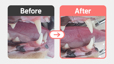 PD3 이상 치주염 진단 후 앞니 발치 수술 진행 모습