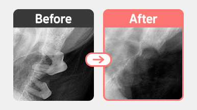 8살 말티즈의 치과 X-ray. PD4 M0 단계 치주염과 약 70%의 치조골 소실 및 치아 분기부(bifurcation) 노출이 확인되는 병변.