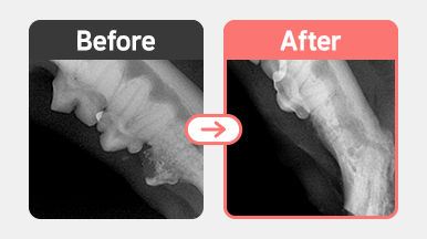 6살 코숏의 치과용 X-ray 이미지. 치주염(PD4 M0)과 치아흡수성병변(FORL)이 동반된 병변으로, 치근 흡수가 진행된 Type 2 양상이 관찰되어 치관 절제술(Crown Amputation)이 시행됨.