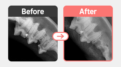 6살 코숏의 치과 X-ray 이미지. 치아흡수성병변(FORL) Type 2 양상이 관찰되며, Crown Amputation이 시행된 병변 부위.