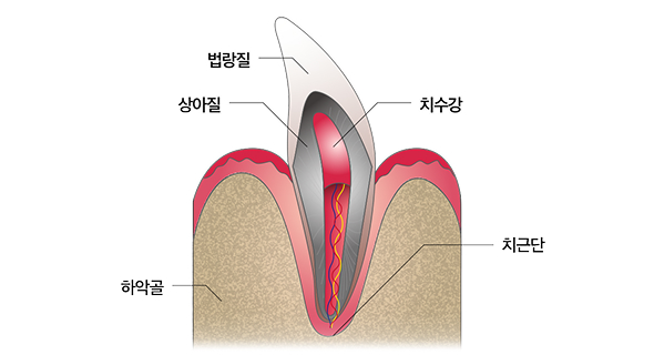 치아 단면구조