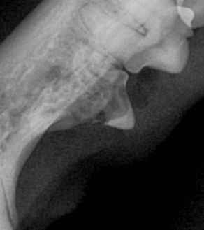 수술케이스 2 before