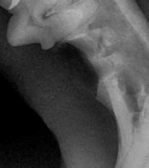 수술케이스 3 after