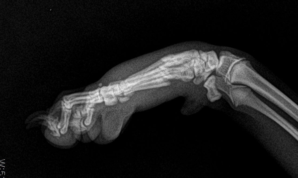 수술케이스 1 before