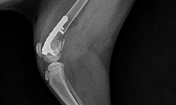 수술케이스 3 after