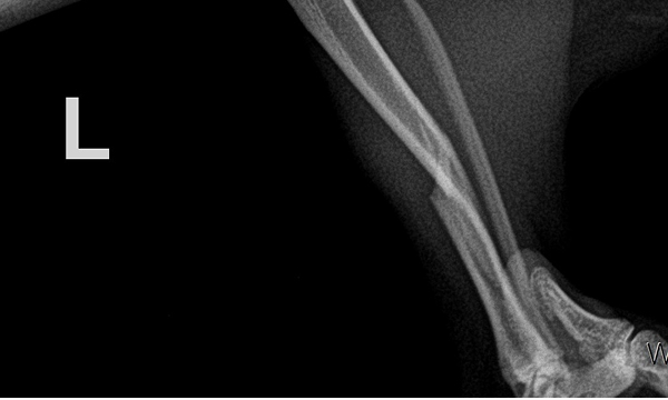 수술케이스 4 before