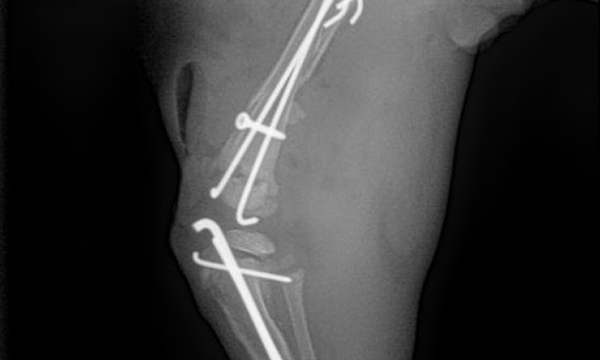 수술케이스 5 after