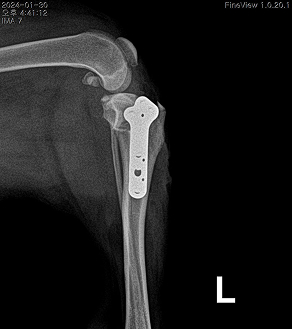 수술케이스 1 after