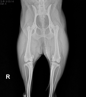 수술케이스 1 before