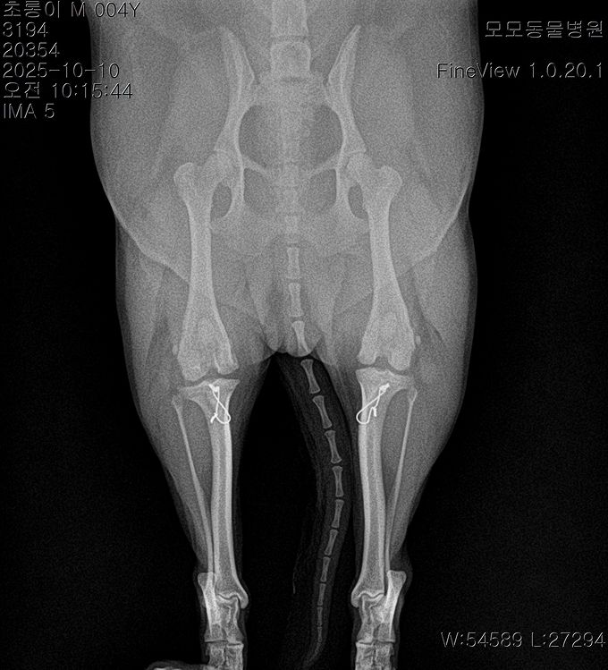 수술케이스 3 after