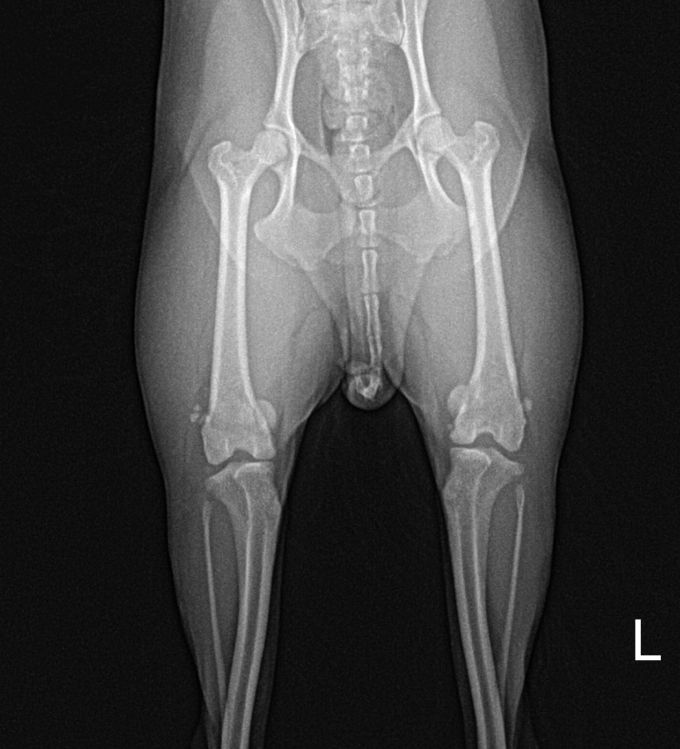 수술케이스 4 before