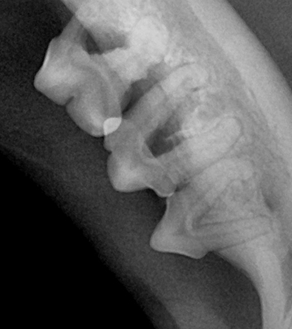 수술케이스 1 before