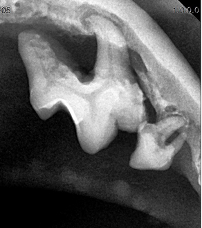 수술케이스 3 before
